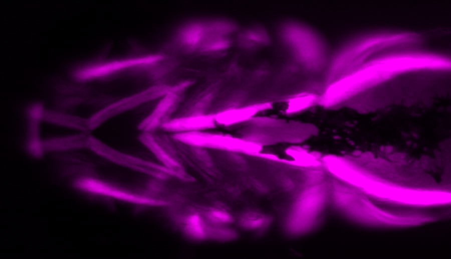 Fluorescence microscopy image of a zebrafish larva, with bright signal highlighting muscle cells in and around the head.