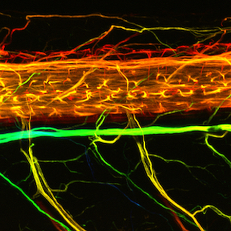 GeneWeld pPRISM-Fuse: vim-1 expression in zebrafish